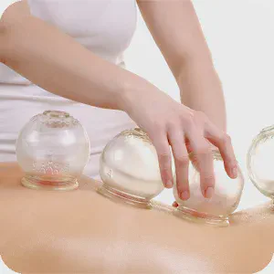 Cupping for Pelvic Floor Health: An Effective Treatment Option or a Waste of Time?
